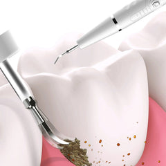 Electric Portable Ultrasonic Dental Scaler Tooth Calculus Remover Tooth Stain Tartar Cleaner Dentist Whiten Teeth for Oral Care Tool