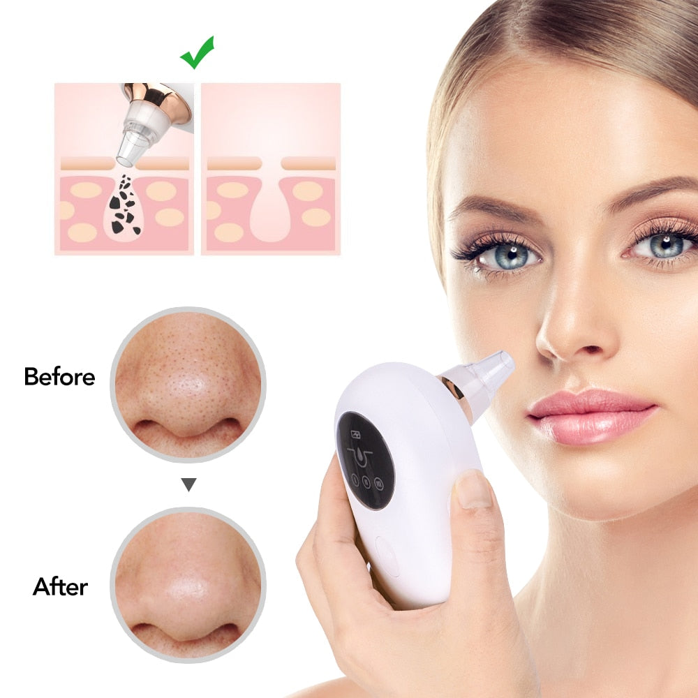 Face Pore Cleaner Remover Blackhead Skin Vacuum Acne Suction Extractor