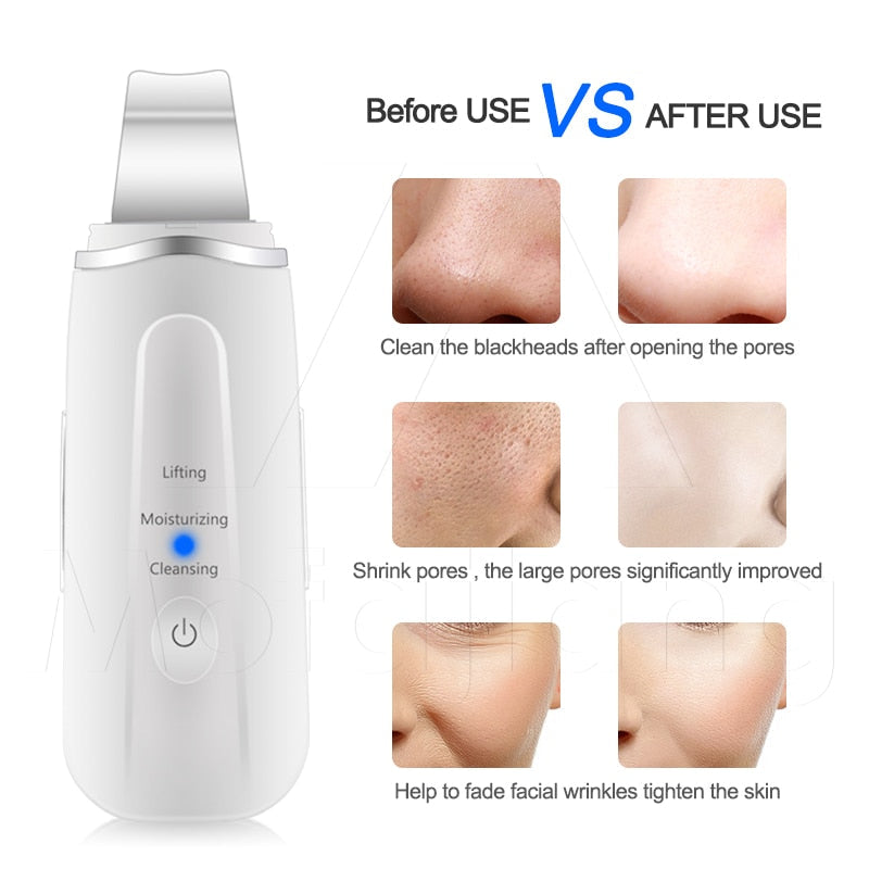 Blackhead Wrinkles Remover Vibration Massage Machine Deep Facial Cleansing Ultrasound Skin Scrubber