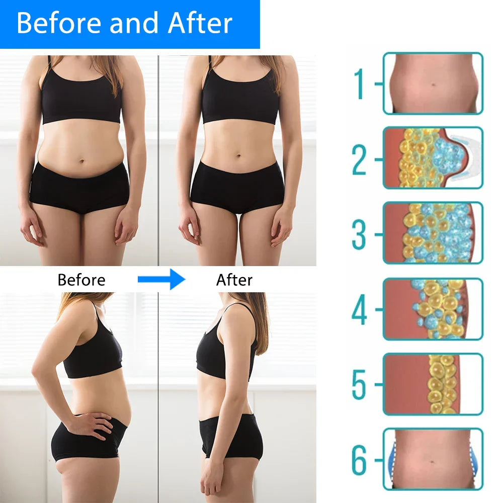 Mini Cryotherapy Device for Fat Loss, Anti-Cellulite, Body Slimming, Cold Compress