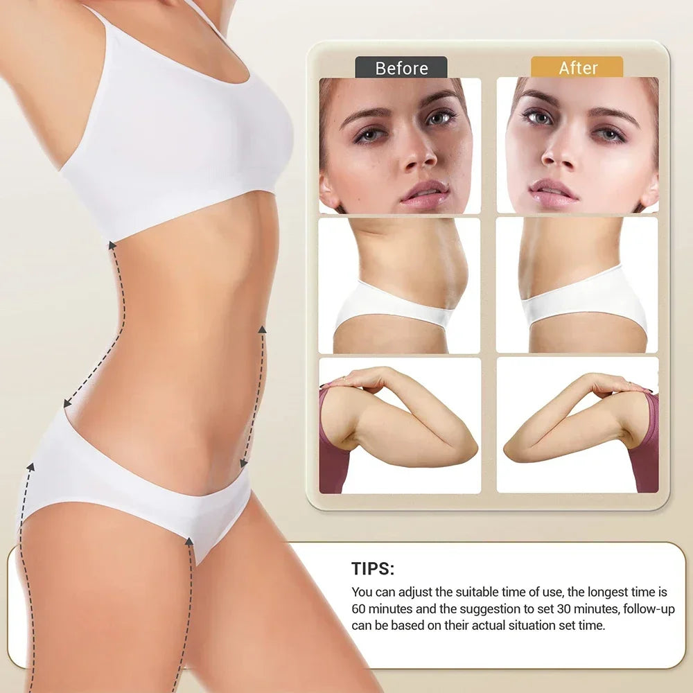 Ultrasonic Cavitation RF Machine for Body Slimming, Skin Tightening & Weight Loss