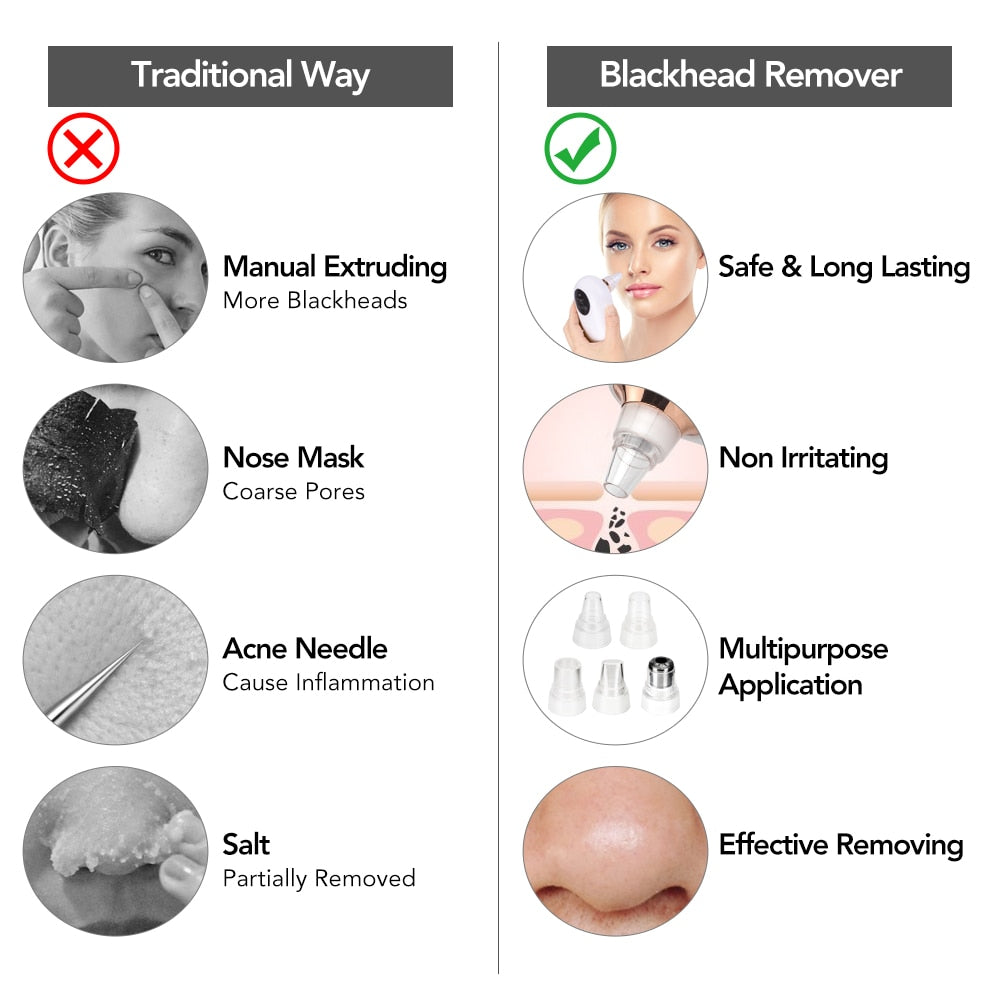 Face Pore Cleaner Remover Blackhead Skin Vacuum Acne Suction Extractor