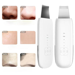 Ultrasonic Face Cleaner Skin Scrubber Care Massager Facial Tighten Anti-aging Wrinkle Removal